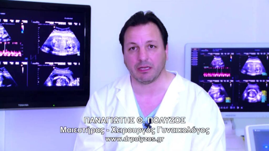 ΜΑΙΕΥΤΗΡΑΣ ΧΕΙΡΟΥΡΓΟΣ ΓΥΝΑΙΚΟΛΟΓΟΣ ΑΘΗΝΑ - ΔΡ. ΠΑΝΑΓΙΩΤΗΣ ΠΟΛΥΖΟΣ