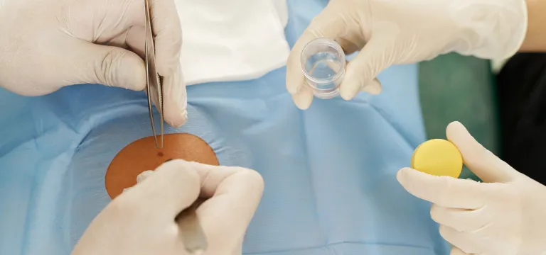 Βιοψία τροφοβλάστης (CVS)